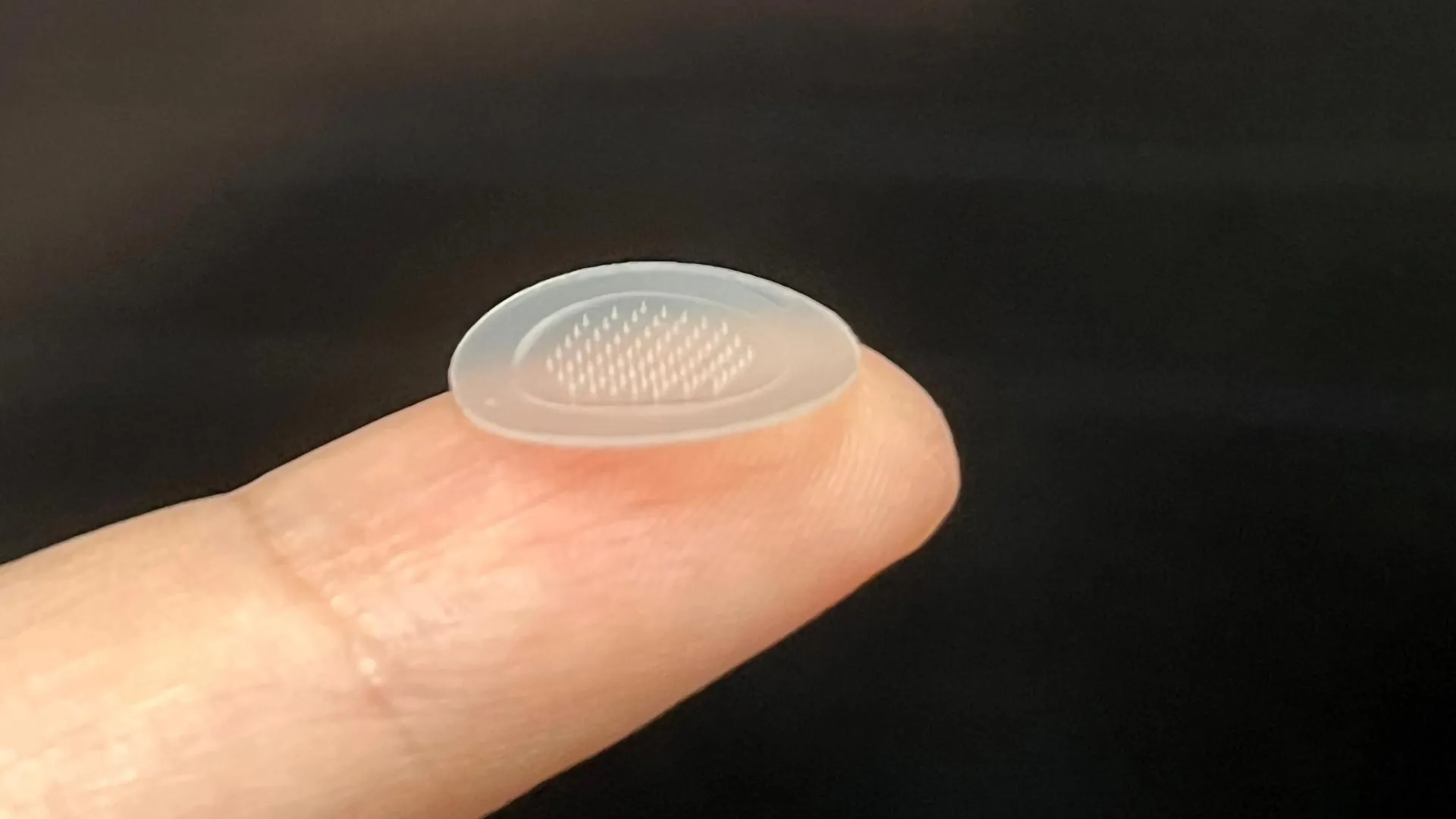 Бархатная кожа за неделю с помощью этого революционного пластыря от прыщей