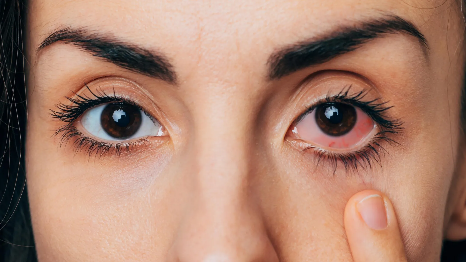 Половина взрослых страдает сухостью глаз, но большинство из них никогда не получают помощи.