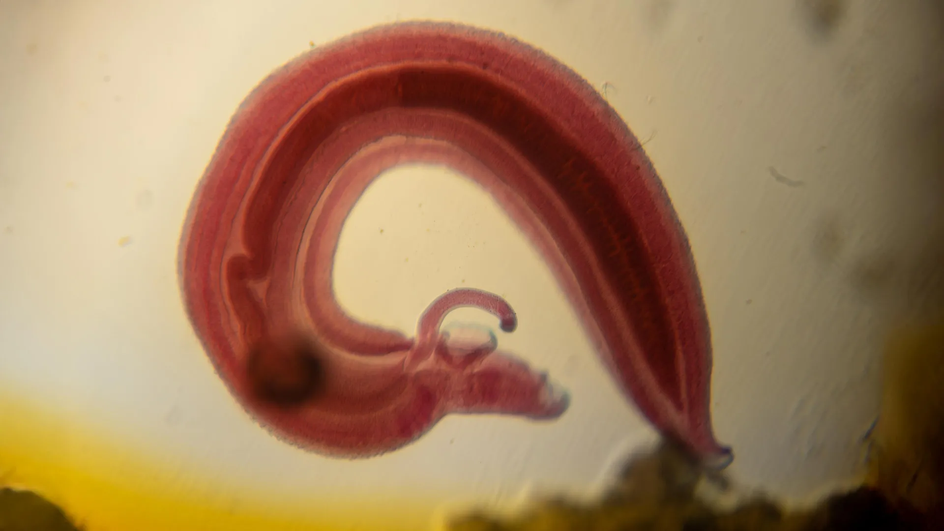 Parasite's Pain-Suppressing Mechanism Exploited for Stealthy Invasion