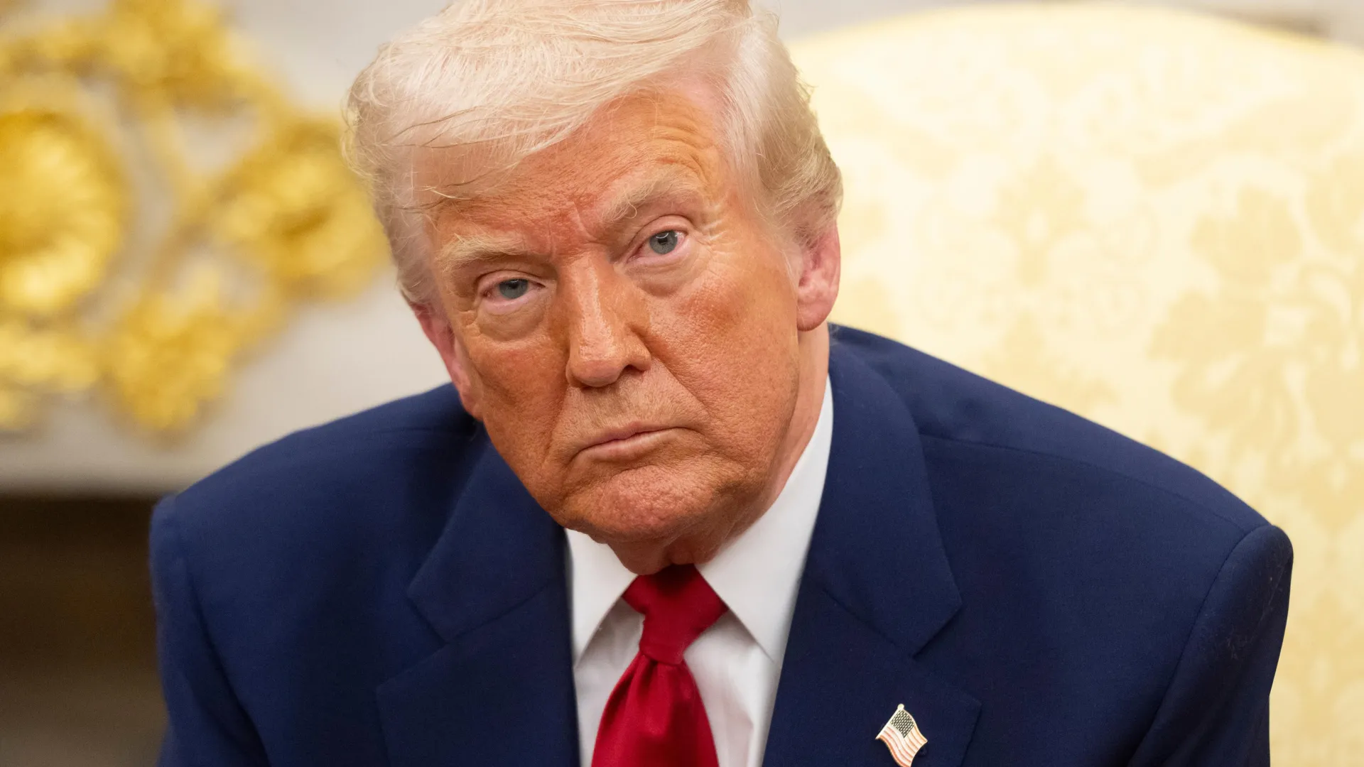 Почему опухоль на ноге Трампа может быть предупреждением для миллионов людей